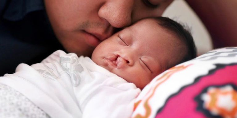 ¿Qué es el labio y paladar hendido?