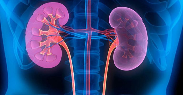 diabetes_enfermedad_renal